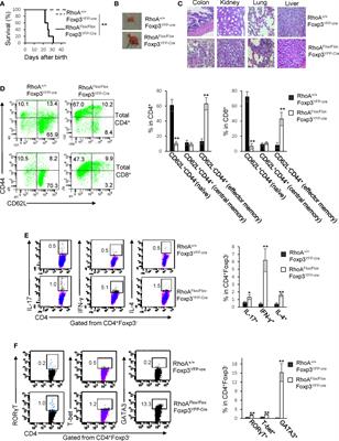 Graded RhoA GTPase Expression in Treg Cells Distinguishes Tumor Immunity From Autoimmunity